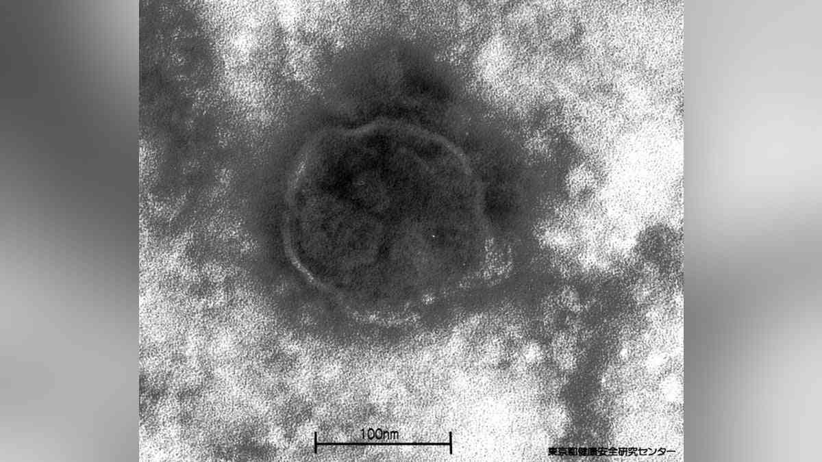 はしか感染者、都内で新たに１５人確認…ハローワーク渋谷で不特定多数と接触した可能性も : 読売新聞
