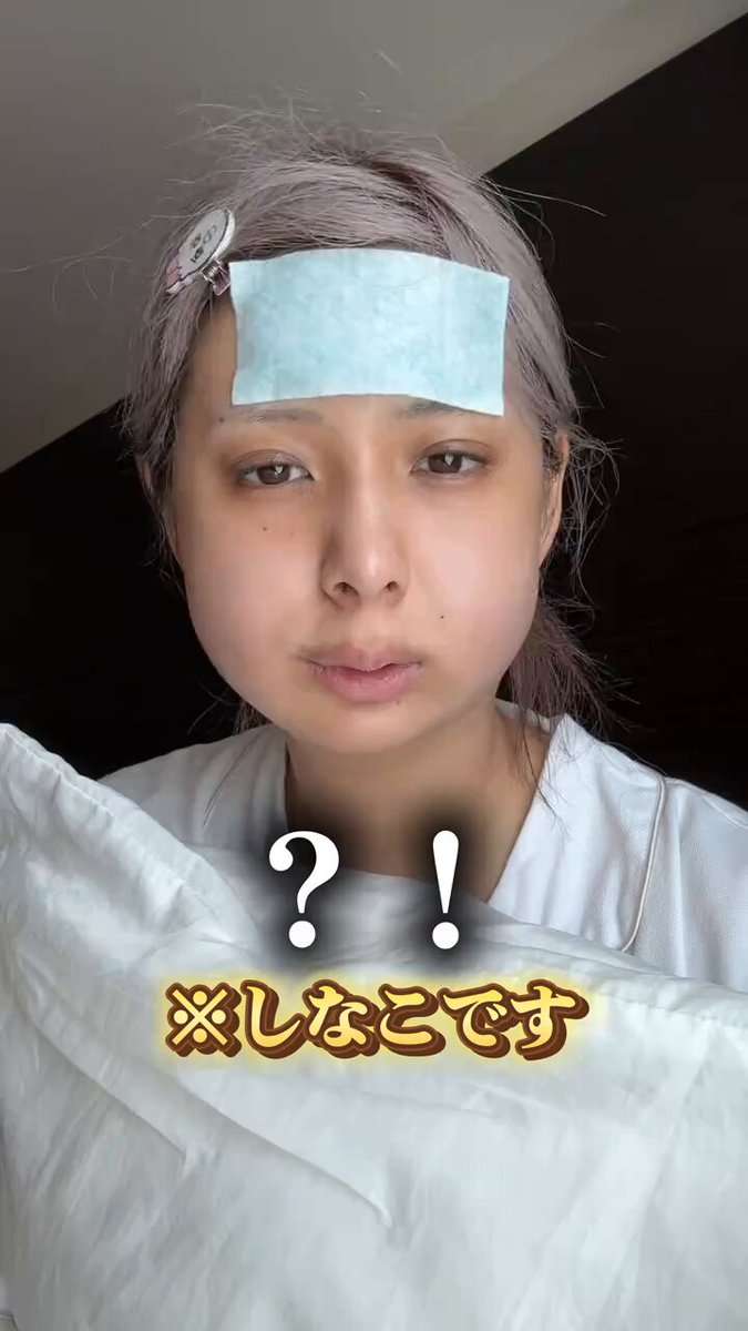 しなこ、両顎の骨切り手術を報告・術後の姿公開「10年くらい前に気づいてからずっとコンプレックスだった」顎変形症で5年前から矯正