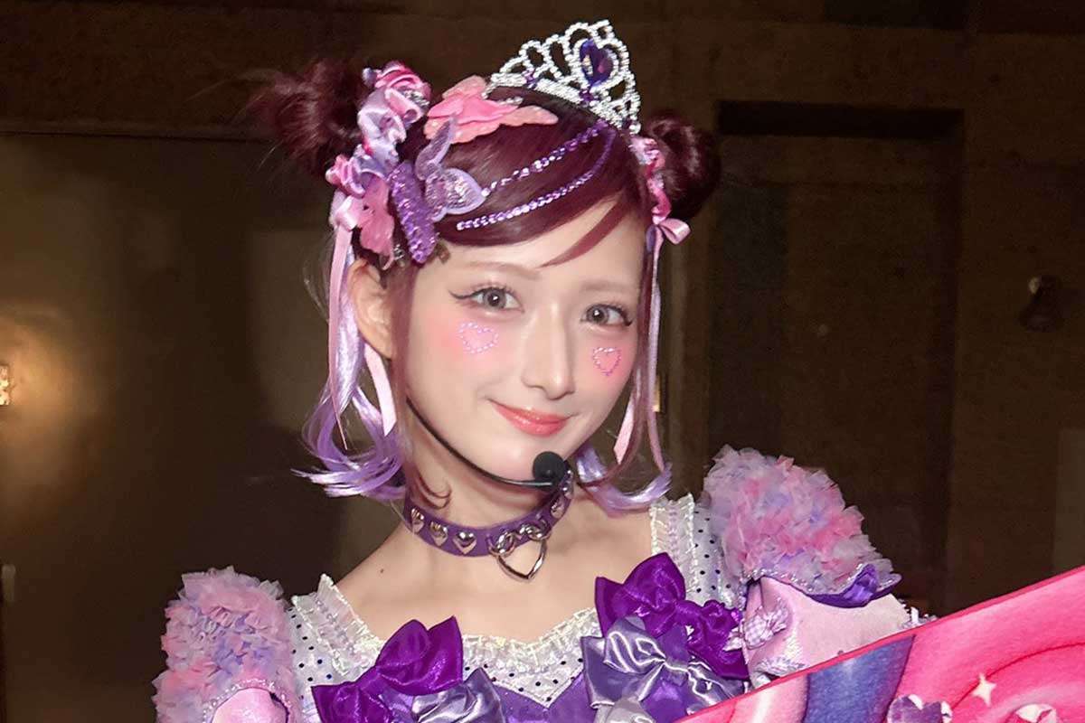 しなこ、両顎の骨切り手術を報告・術後の姿公開「10年くらい前に気づいてからずっとコンプレックスだった」顎変形症で5年前から矯正