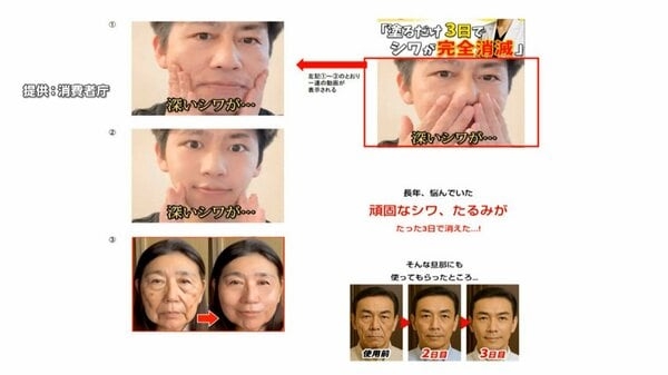 「シワ、たるみが3日で消えた」「初回限定1980円」など違法表示　美容クリーム販売会社に業務停止命令　消費者庁｜FNNプライムオンライン