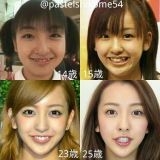 >>369新垣結衣目もは鼻も輪郭も歯も歯茎も顔のパーツでいじってないところは無いよ？ | ガールズちゃんねる - Girls Channel -