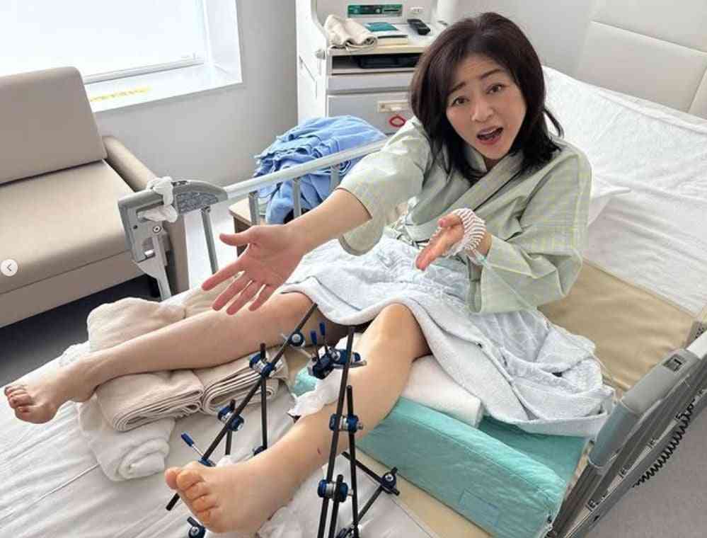 松本明子、自宅前で転倒→骨折 1ヶ月入院で「しばらくの間休業」、足以外のけがはなし