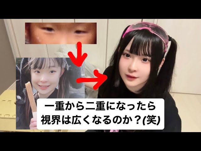 最初は中3のとき、母親に勧められ――YouTuberゼパが整形にまつわる質問に答える - YouTubeニュース | ユーチュラ