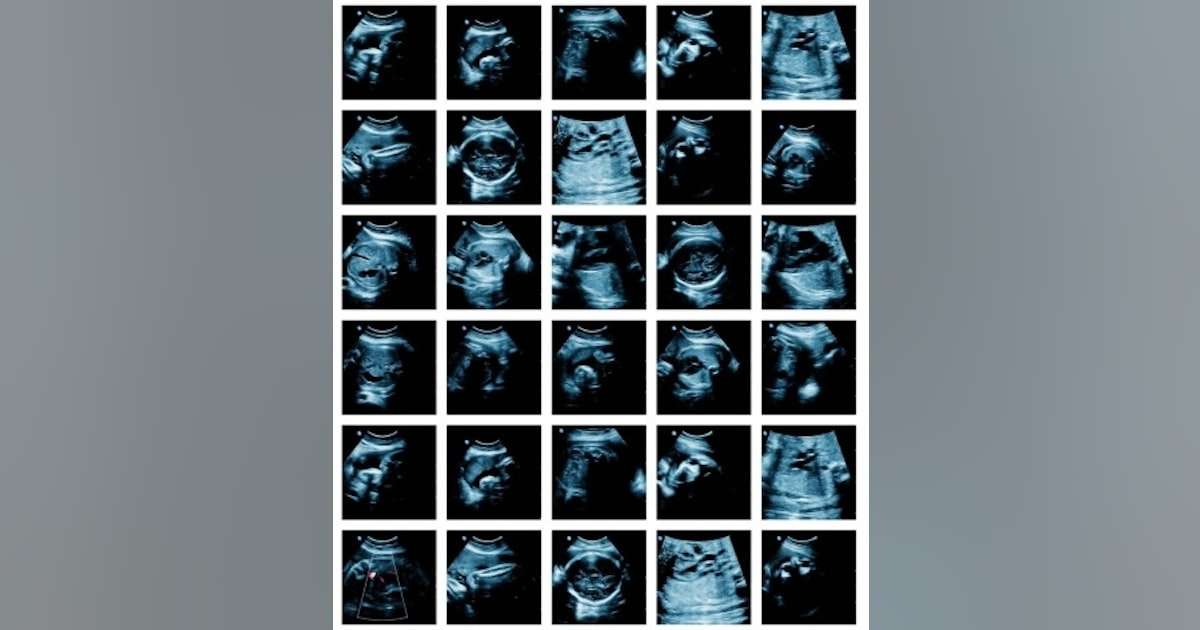 女性が妊娠する能力は35歳で本当に急降下するのか？ - 日本経済新聞