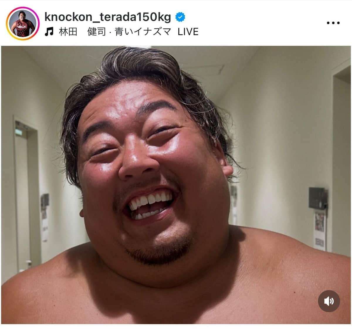 ブレイキングダウン元戦士、「痩せてキムタクになりました」...SNS投稿にファン「お顔のポテンシャル高すぎ」