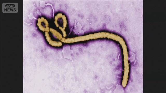 エボラ出血熱に米国人1人が感染　CDCが入国制限も　W杯代表の対策も検討（テレビ朝日系（ANN）） - Yahoo!ニュース