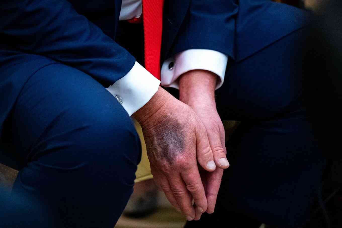 トランプ氏、健康診断終え「すべて完璧」-詳細は明らかにせず