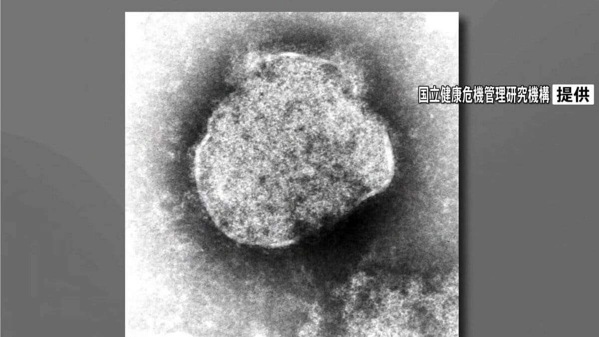今年のはしか感染者数436人 400人超える 過去10年で2番目 厚生労働省 TBS NEWS DIG