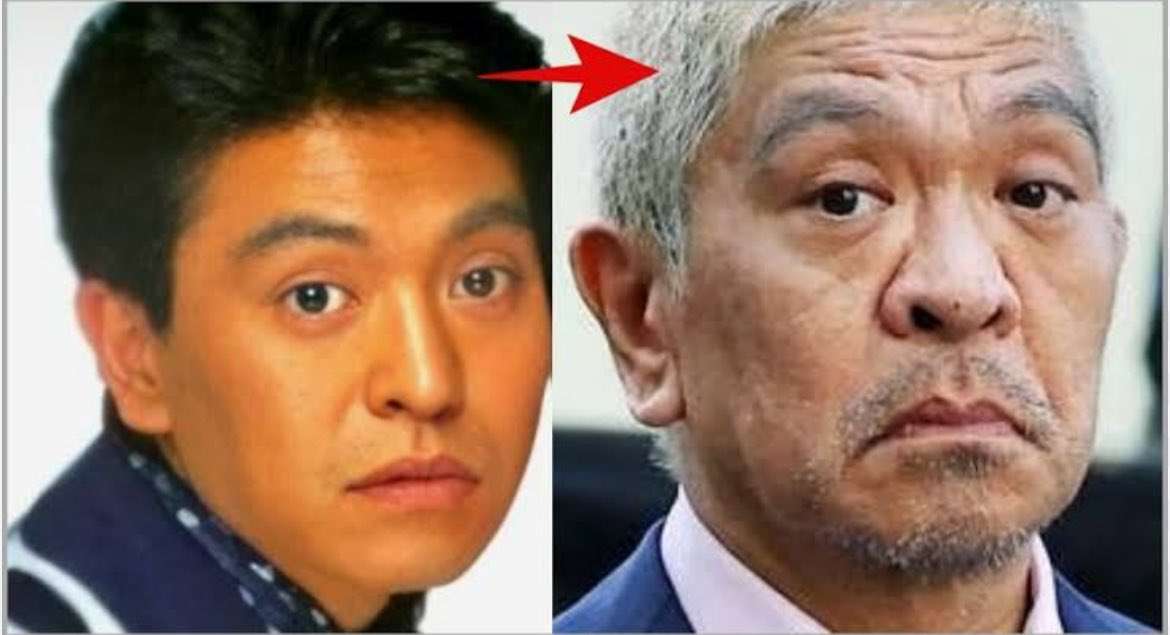 年取って顔が丸くなる？こける？