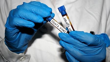 台湾・台北を中心にネズミが大量発生、ハンタウイルス感染例も確認、行政の対応に市民の不満が高まる事態に（東洋経済オンライン） - Yahoo!ニュース