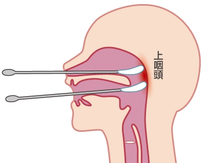 月1で風邪を引いてたイモトアヤコ、“ある方法”の効果抜群で…　「鼻うがいより」「免疫力が上がる」