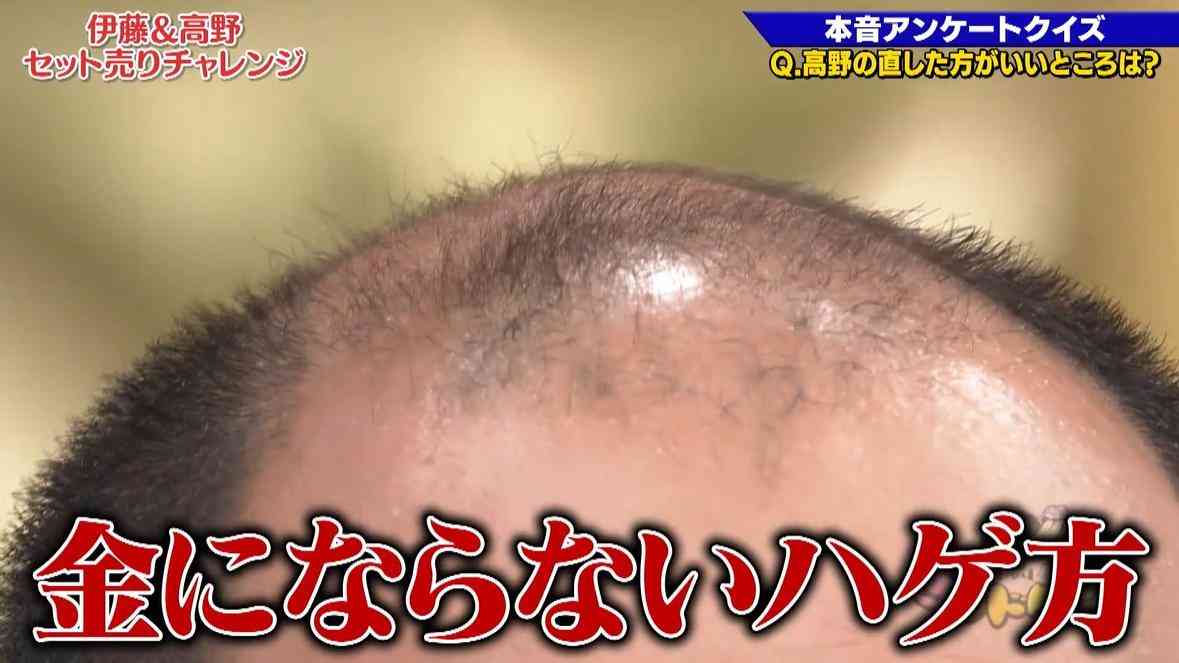 もしも好きな人がカツラだったらどうしますか?