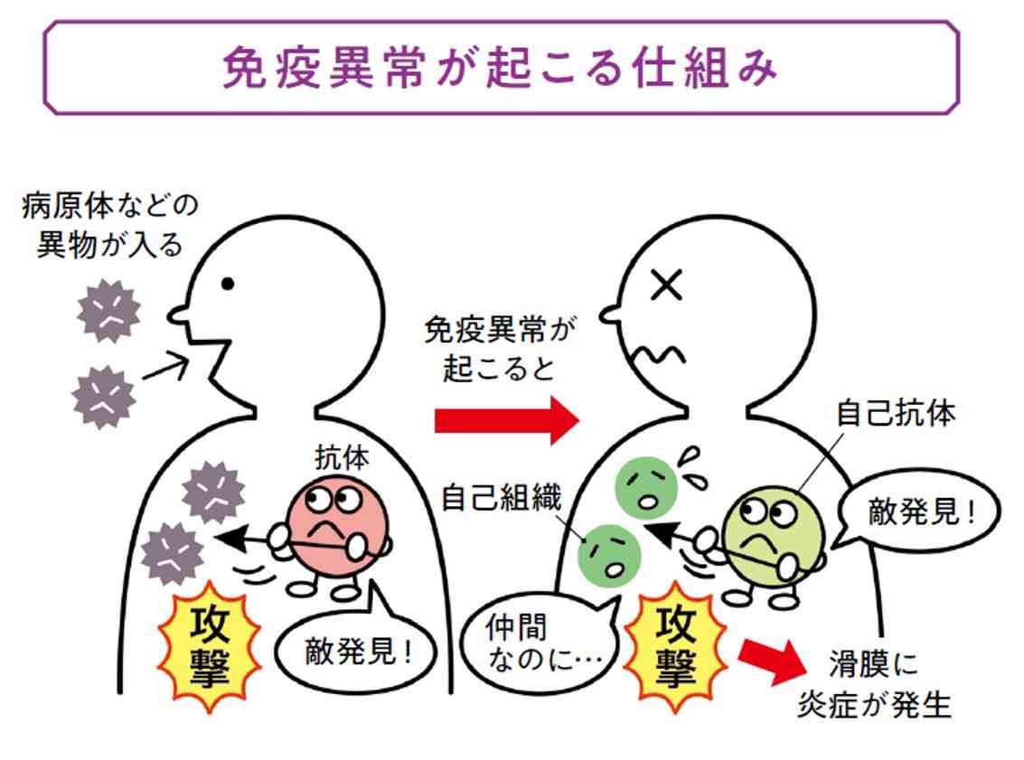 自己免疫疾患の方