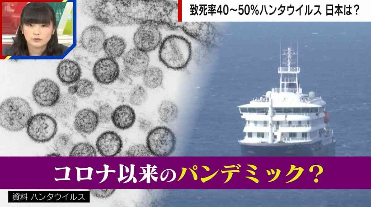 「特効薬がない」致死率40〜50%の“ハンタウイルス”日本での流行リスクは？医師は「はしかの方が危ない」と警鐘 | 国内 | ABEMA TIMES | アベマタイムズ