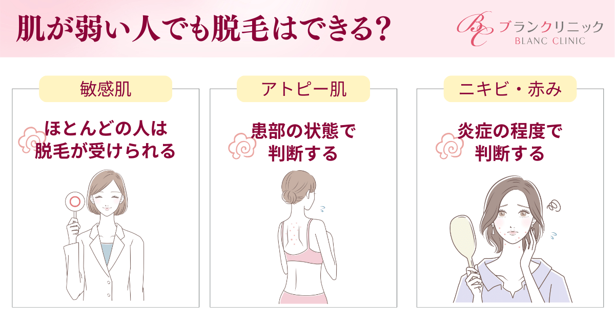 アトピー肌の脱毛、肌ケア