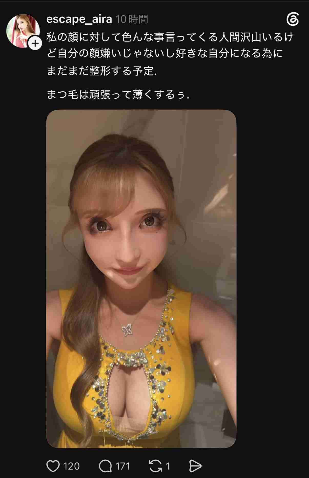 【整形】加齢によるたるみを取りたい