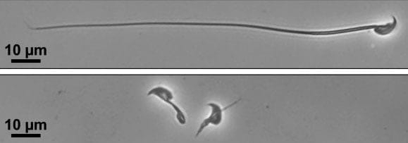 精子運動、特定タンパク質が必要　不妊治療に期待、大阪大