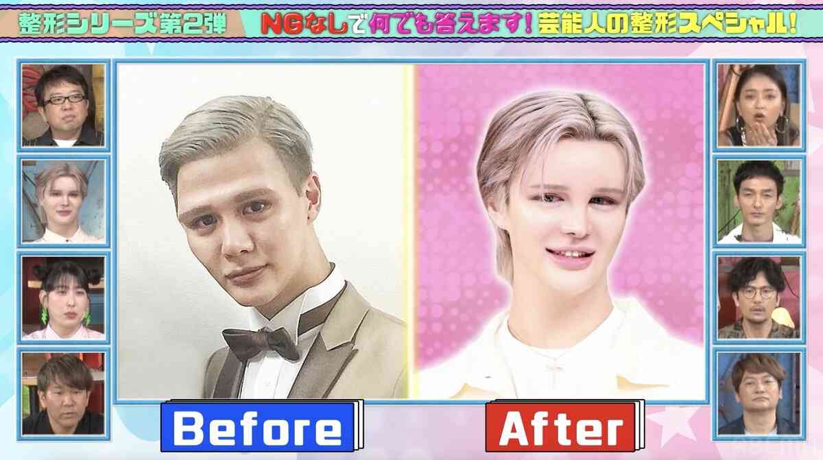 Matt、美容整形のビフォーアフターを披露「昔は家に帰るとパパが腰抜かしてた」 | バラエティ | ABEMA TIMES | アベマタイムズ