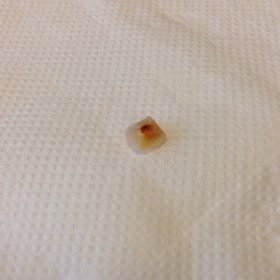 ポテト「人の歯」はフライされていない？　マクドナルド説明でも謎は深まるばかり: J-CAST ニュース【全文表示】