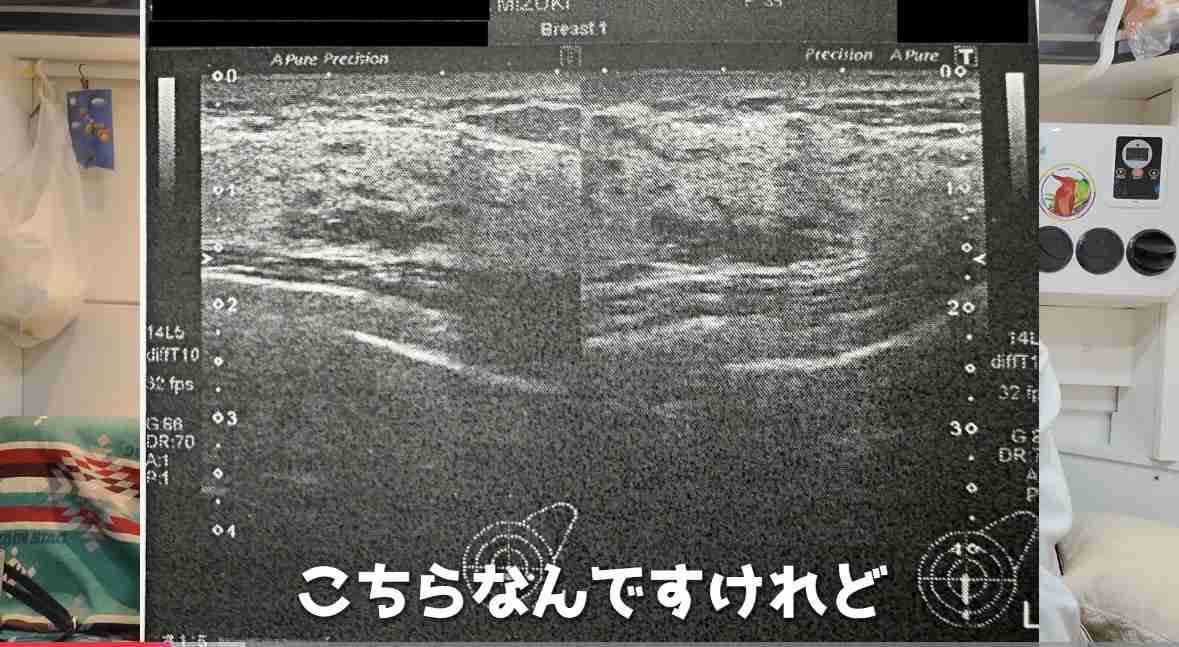 ゼロだと嬉しいこと