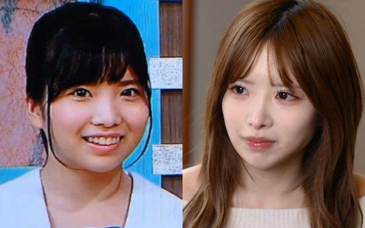 「顔が悪いから人気がないんだ」10代アイドルが【36キロ・ガリガリ体型】に⋯彼女を追い詰めた「握手会の闇」 | それぞれの美容整形、それぞれの理由 | 文春オンライン