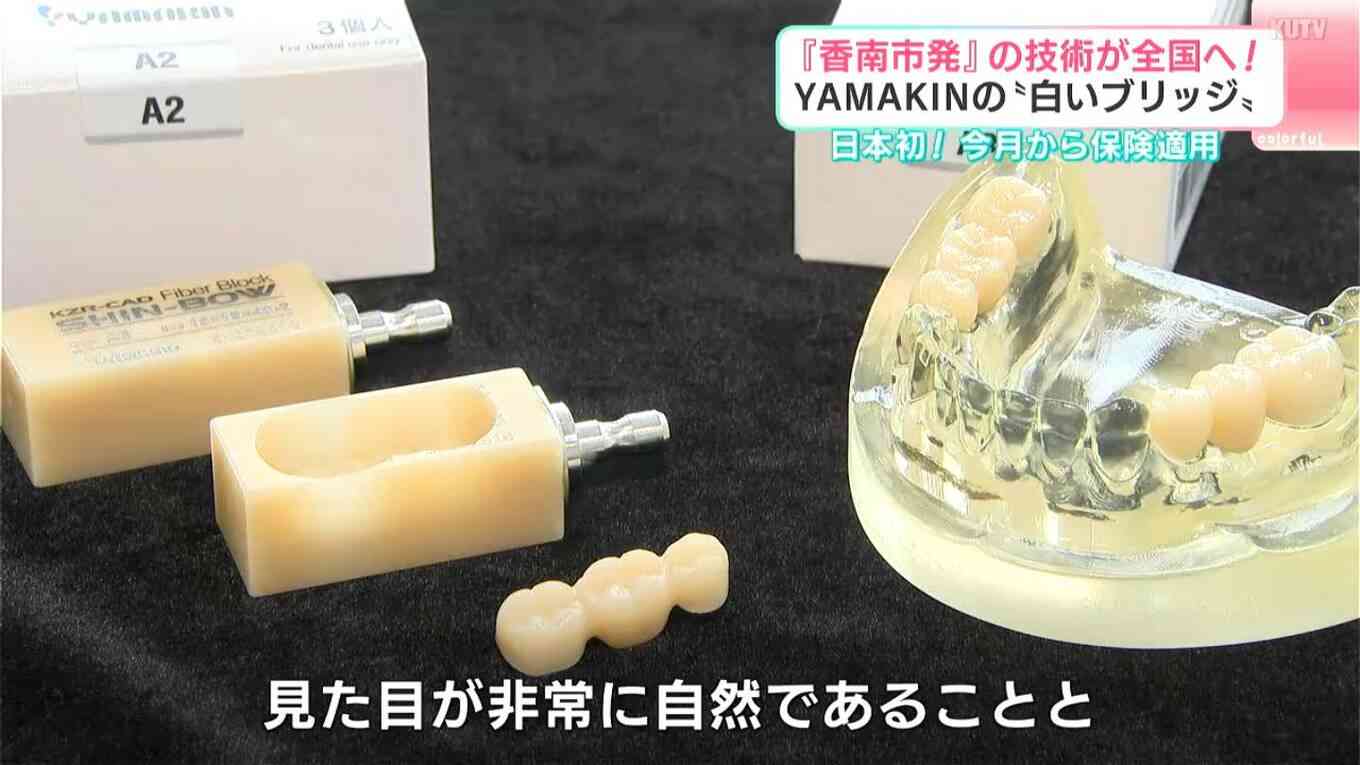 銀歯ではなく“白い歯”のブリッジ、初の保険適用で治療費3割安く 樹脂製の歯科材料「SHIN-BOW」が担う歯科治療の未来【YAMAKIN開発】