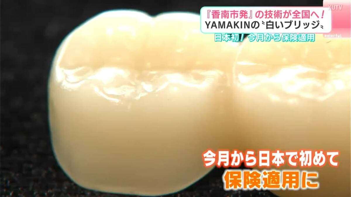 銀歯ではなく“白い歯”のブリッジ、初の保険適用で治療費3割安く　樹脂製の歯科材料「SHIN-BOW」が担う歯科治療の未来【YAMAKIN開発】 | TBS NEWS DIG