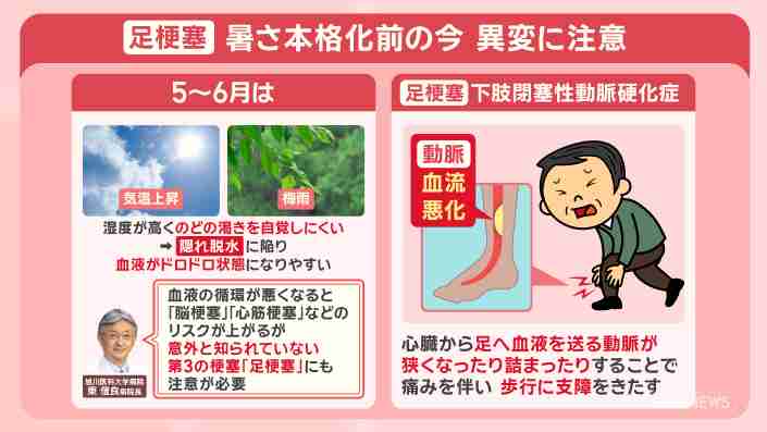 カルーセル麻紀さん発症『足梗塞』痛みで歩けず“切断寸前”に 病気のサイン＆予防法（テレビ朝日系（ANN）） - Yahoo!ニュース