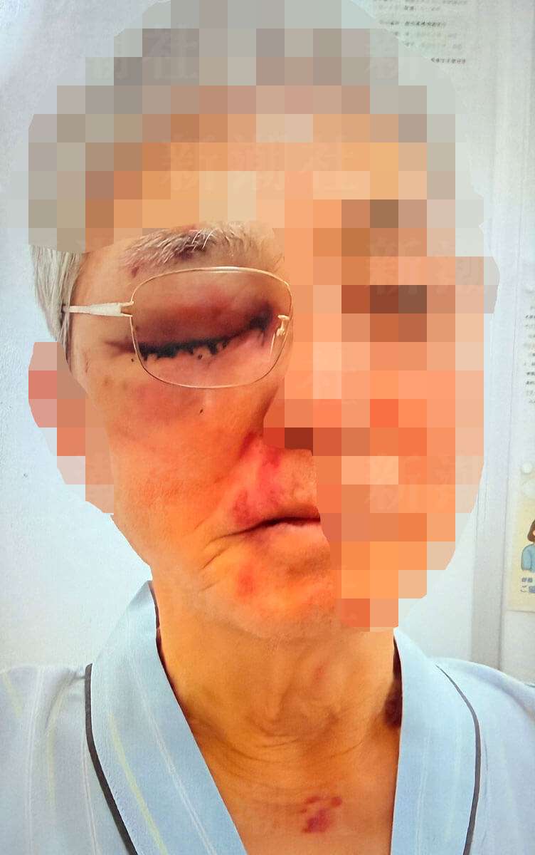 “バールで頭を殴打”の強盗事件を起こした17歳が「逆送なし」で少年院へ　79歳被害者は「謝罪・弁済がないのに甘すぎる」と激怒　【埼玉・狭山強盗致傷事件】（デイリー新潮） - Yahoo!ニュース