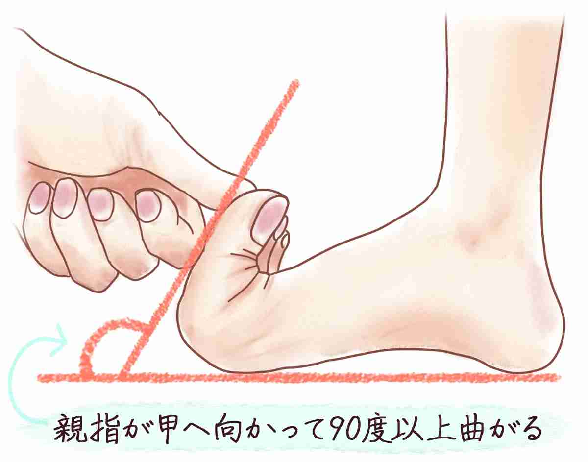 足の指が浮き指