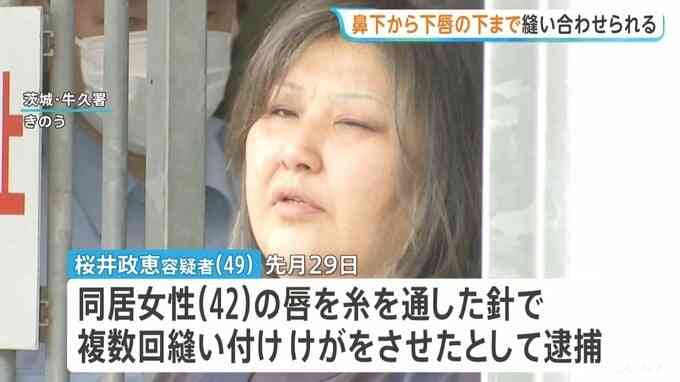 鼻の下から下唇の下までを口の中に糸を通す形で縫われる　女性の唇を縫い付け49歳女が逮捕された事件　茨城・古河市