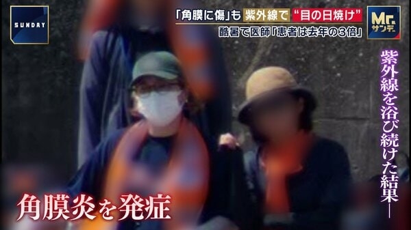 猛暑で目の日焼けに…紫外線浴びて角膜に傷　視力低下・視界悪化の可能性　さらに脳の日焼けで不安や疲労感