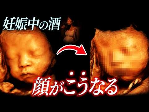 【絶対NG】妊娠中のお酒で胎児が奇形化！？顔の真ん中が...
