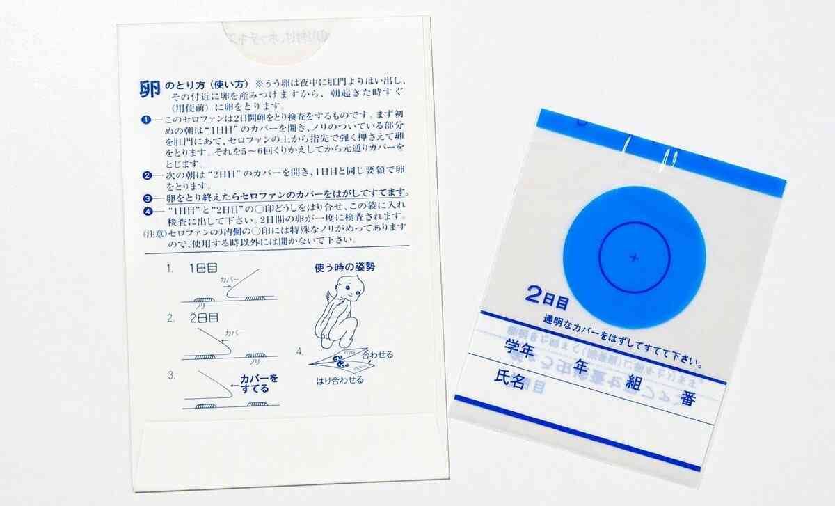「おしりぺったん」はもうやらない？　ぎょう虫検査が消えた理由と、一度に1万個の卵を産む驚くべき生態 | AERA with Kids＋