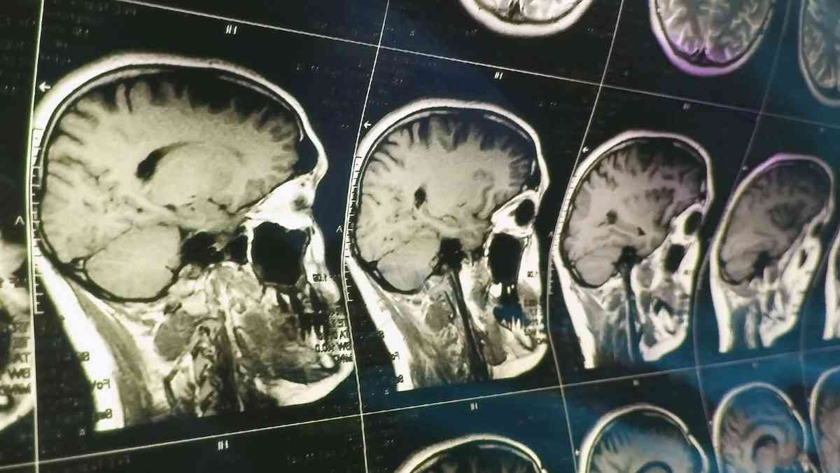 外科手術なしに脳活動から思考を文章化するAIの精度が向上（Meta社） | カラパイア