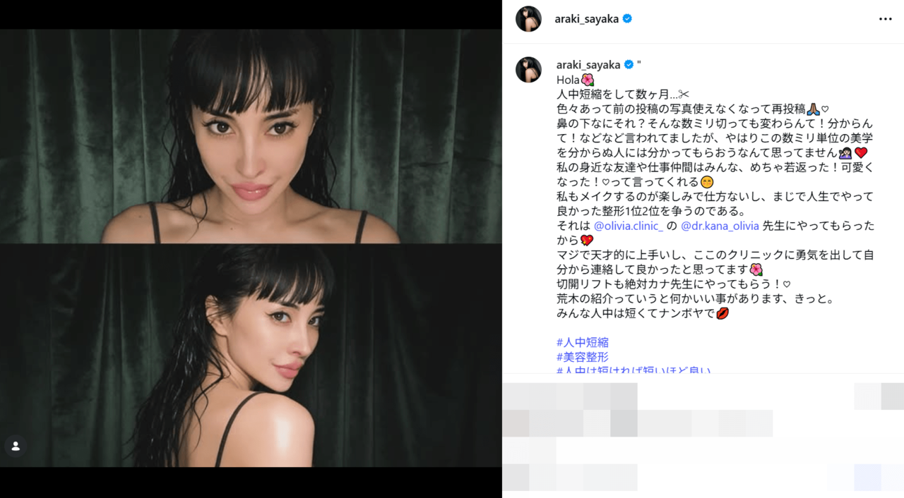 伝説のNO.1キャバギャルモデルが詐欺被害を告白「仲間に裏切られました」 整形で美を追求する41歳の現在地