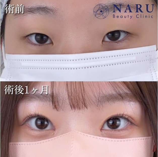 ゼロだと嬉しいこと