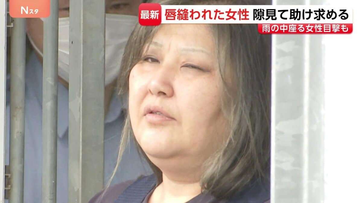 同居女性の唇縫い付けたとして49歳女が逮捕された事件 「女性がどしゃ降りのなか…」近隣住民が目撃した“異様な光景”　茨城・古河市 | TBS NEWS DIG