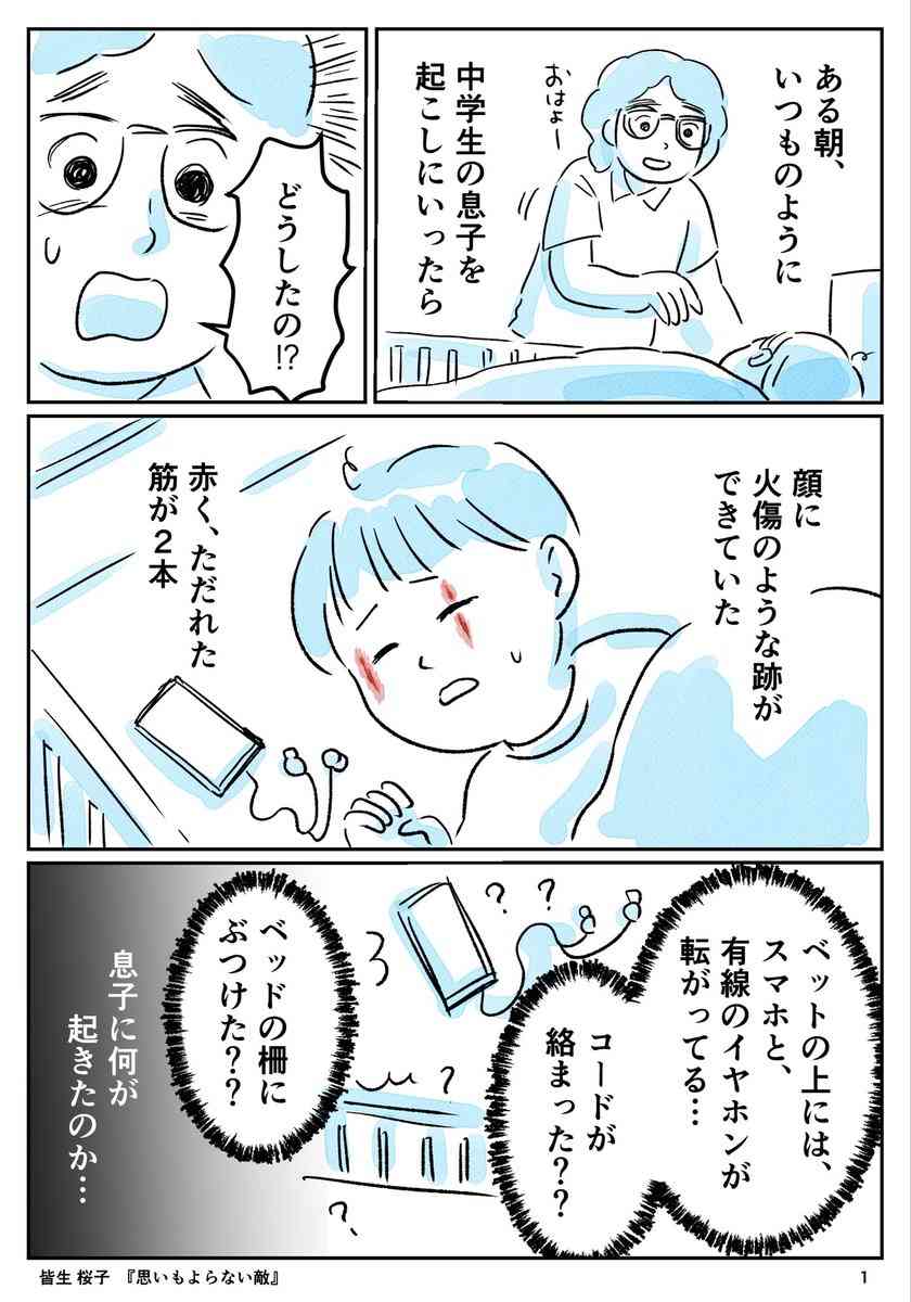 「息子に何が起きたのか…」ある朝、いつものように中学生の息子を起こしにいったら、顔に赤くただれた火傷のような跡が2本できていた話… ただれた箇所はじゅくじゅくしていて、 汁が出ていた