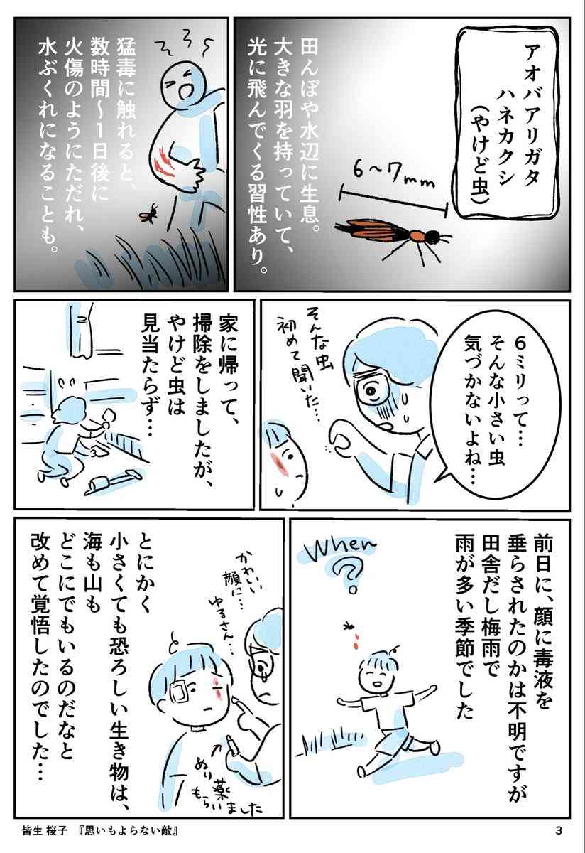 「息子に何が起きたのか…」ある朝、いつものように中学生の息子を起こしにいったら、顔に赤くただれた火傷のような跡が2本できていた話… ただれた箇所はじゅくじゅくしていて、 汁が出ていた