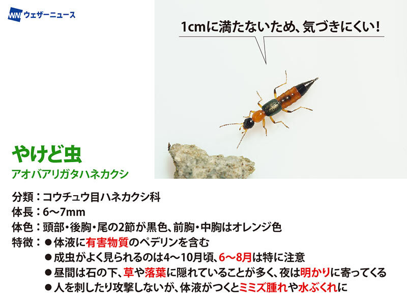 「息子に何が起きたのか…」ある朝、いつものように中学生の息子を起こしにいったら、顔に赤くただれた火傷のような跡が2本できていた話… ただれた箇所はじゅくじゅくしていて、 汁が出ていた
