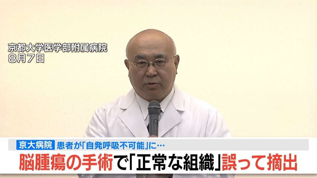【速報】脳腫瘍手術で「正常な組織」を誤って摘出…自発呼吸不能の重篤状態に　「腫瘍でない」結果出ても“勘違い”で摘出継続　通常の生活送っていた患者が手足も動かず　京大病院 | TBS NEWS DIG (1ページ)