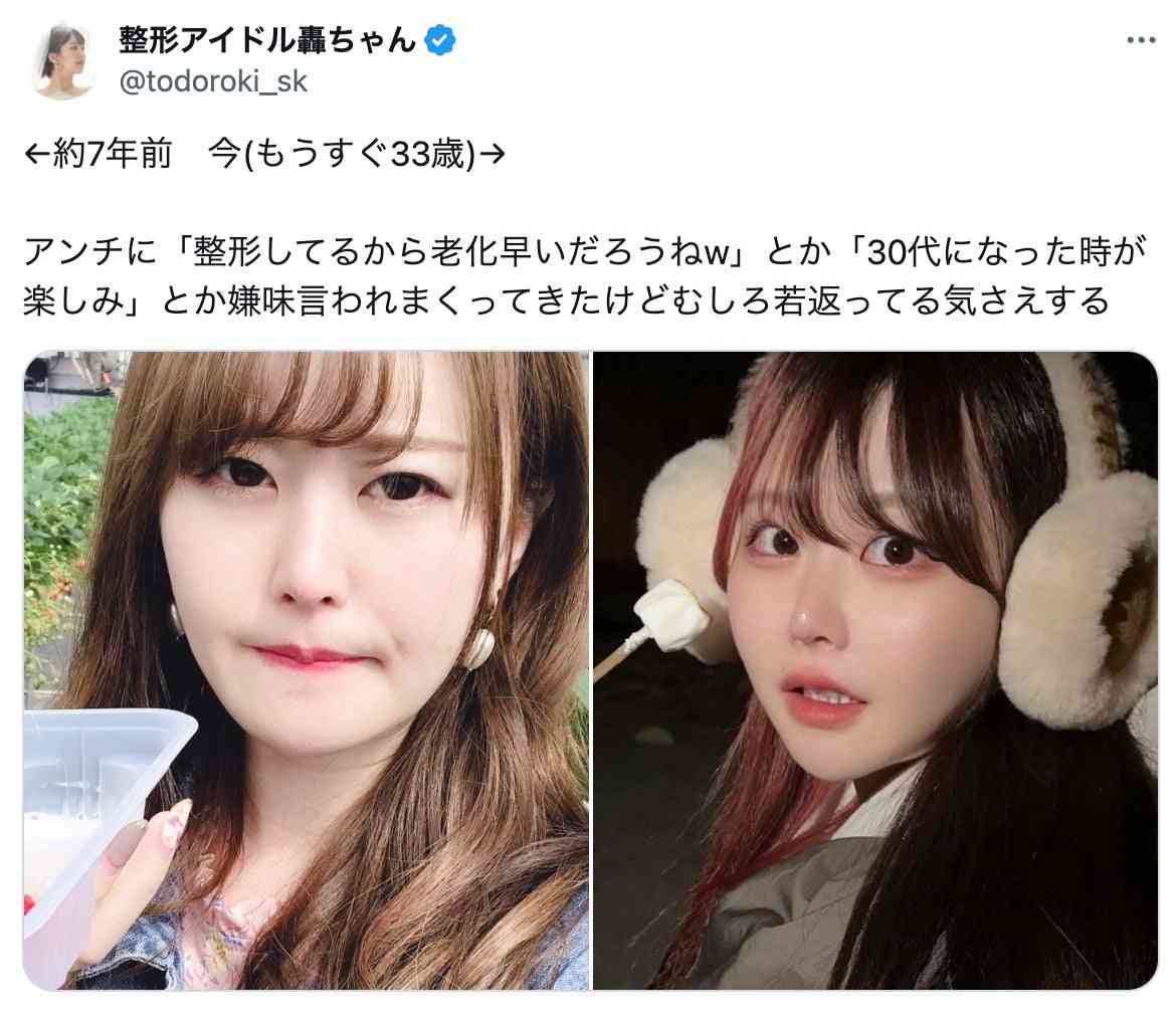 【美容整形】自然と不自然の境界線