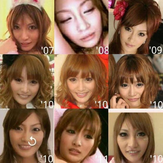 【美容整形】自然と不自然の境界線