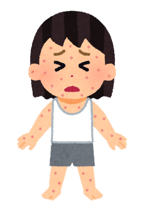 【ウイルス感染症】麻疹（はしか）について知っていること