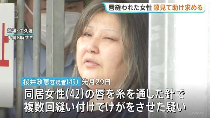 同居女性の唇縫い付けたとして49歳女が逮捕された事件 「女性がどしゃ降りのなか…」近隣住民が目撃した“異様な光景”　茨城・古河市