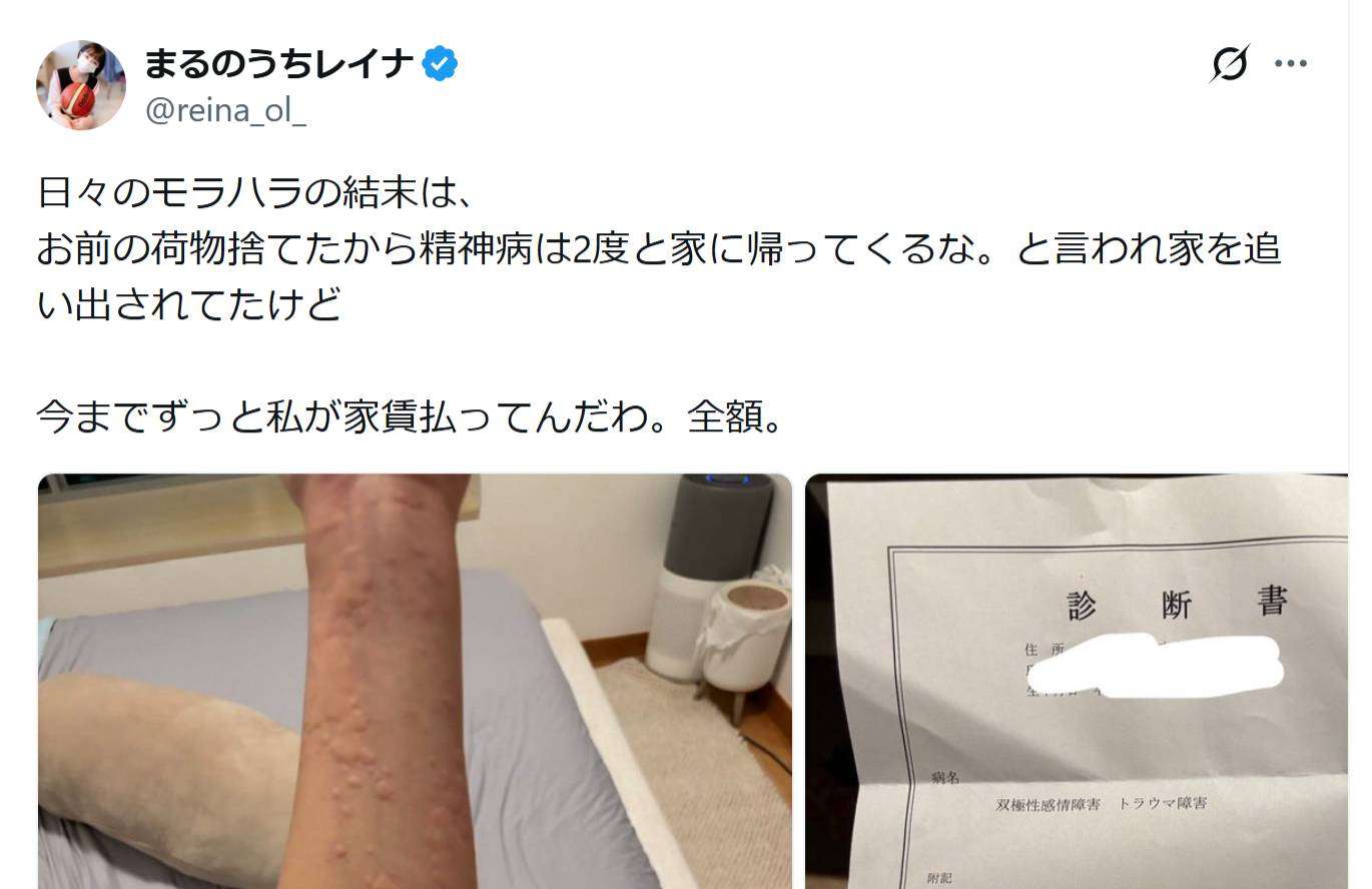 丸の内OLレイナ、元夫からの「日々のモラハラの結末」をつづる　腕の発疹や診断書も公開 - YouTubeニュース | ユーチュラ