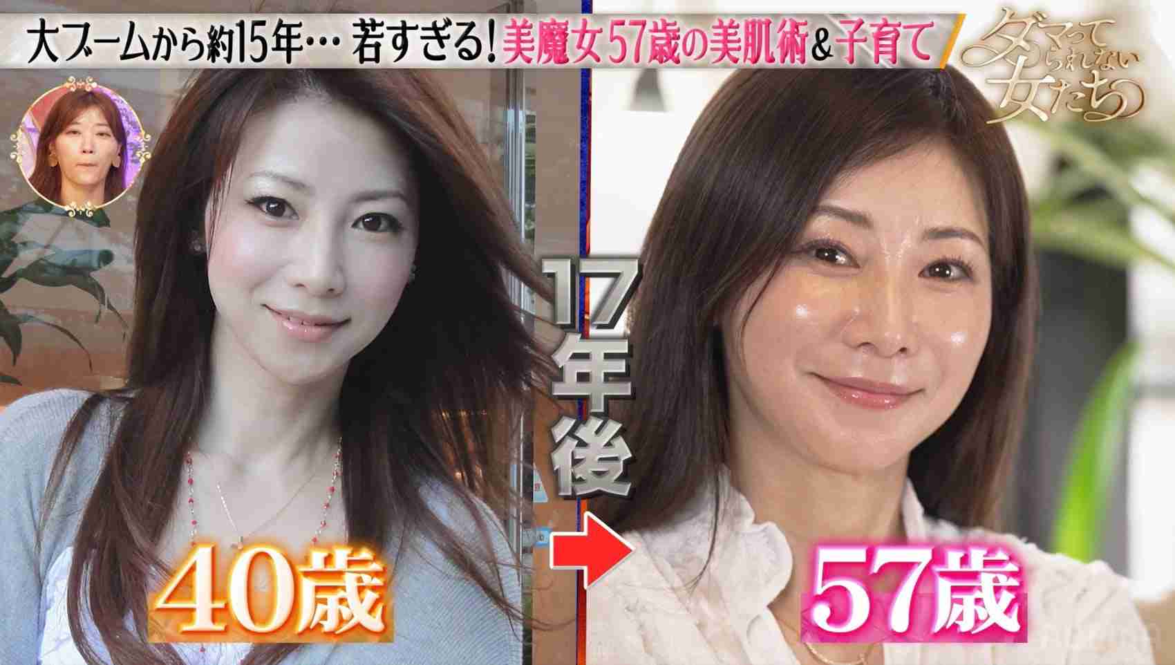【美容整形】自然と不自然の境界線