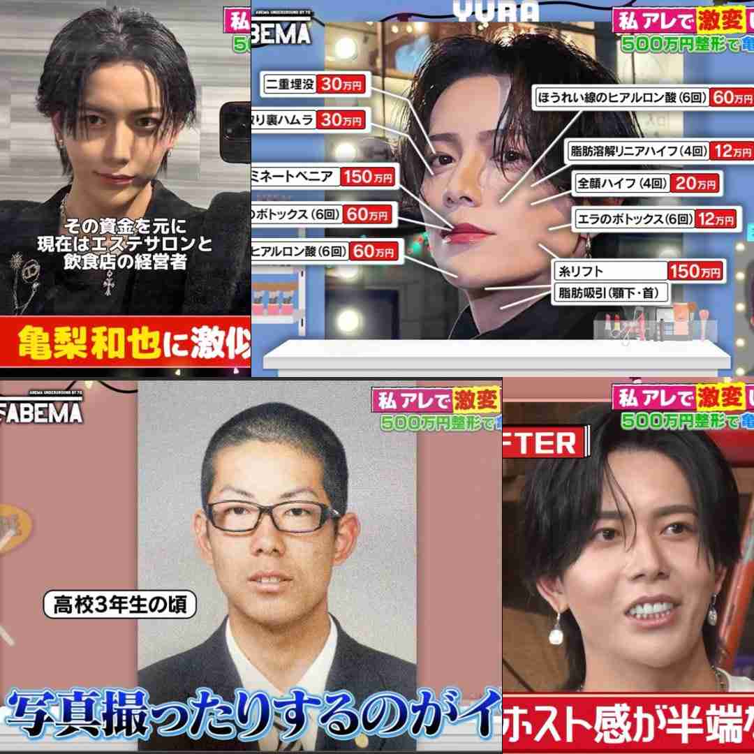 整形総額500万円で亀梨和也似に激変!きっかけは彼女の浮気&ホスト不合格