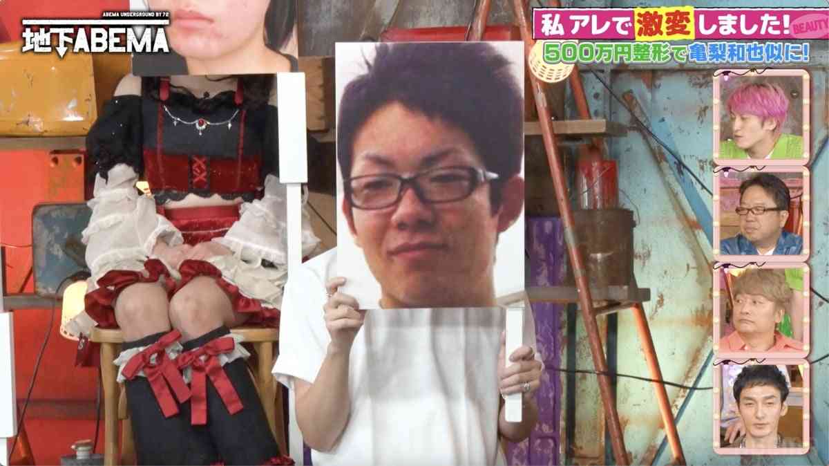 整形総額500万円で亀梨和也似に激変！きっかけは彼女の浮気＆ホスト不合格  | オリコンニュース（ORICON NEWS）